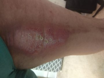 IMG_20191204_204720078 (1).jpg